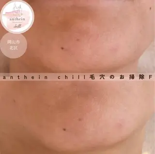 アンテインチル 山本のエステ・リラクイメージ