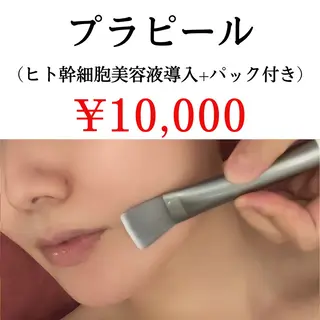毛穴ケア＆脱毛サロン　ADEL WEISS所属・毛穴ケア＆脱毛サロン ADEL　WEISSのエステ・リラクイメージ