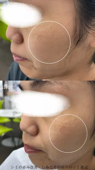 デ・アイム塚口所属・肌質/体質改善 久下玲菜のエステ・リラクイメージ