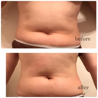 サロンフリーム リンパマッサージのエステ・リラクイメージ