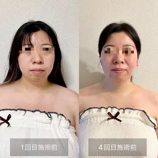 Hi, I am 1 PARAFUSE.所属・カラダとココロ 癒されほっと一息のエステ・リラクイメージ