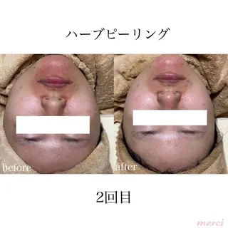 salon merci和泉のエステ・リラクイメージ