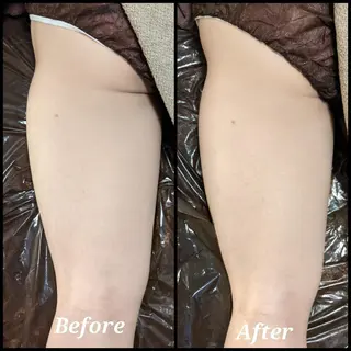 整体エステ　NEW ME所属・深層リンパオイル/小 顔とドライヘッドスパのエステ・リラクイメージ