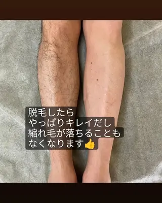 プライベートサロン宿り木所属・江坂@宿り木　脱毛＆ 耳ツボジュエリーのその他イメージ