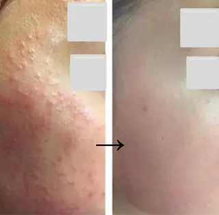 自爪育成ネイルサロン ココリュバンのネイルデザイン