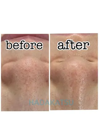 総合エステサロン 肌活のエステ・リラクイメージ