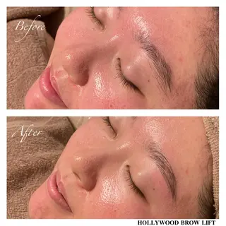 アイブロウ B&H所属・頭痛•肩こり専門/ 眉サロンB&H心斎橋のエステ・リラクイメージ