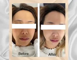 ENCHANT 脱毛.小顔.毛穴のエステ・リラクイメージ