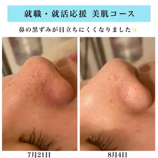 Bellesthe (ベルエステ)のエステ・リラクイメージ