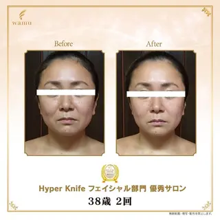 所沢痩身小顔コルギ AromaQueenのエステ・リラクイメージ