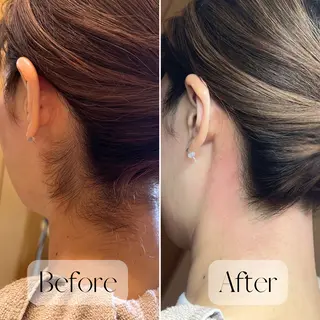 プライベート脱毛サロン　Arum所属・脱毛サロン Arumのエステ・リラクイメージ