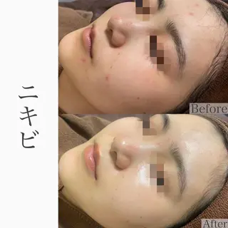 ハーブピーリング専門 BIOEL横浜のエステ・リラクイメージ