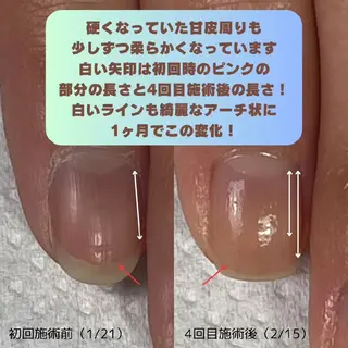 ネイル nail 1623のネイルデザイン
