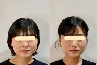 最速小顔・肌質管理 ❣️エスポワールのエステ・リラクイメージ