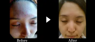 ショート ミディアム セミロング ヘアアレンジ パーマ カラー ロング メンズ キッズ ネイル マツエク・マツパ 次世代まつげパーマは 『リベル名古屋』のマツエク・マツパデザイン