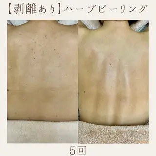 肌質改善サロン renew所属・肌質改善サロン renew/ｳｴｷのエステ・リラクイメージ