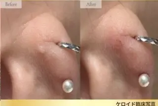 amor Beautyのマツエク・マツパデザイン