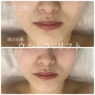 フェイシャルサロン CHIARA 荒田のエステ・リラクイメージ