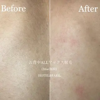 HOTEL&PARK .Moeワックス脱毛のエステ・リラクイメージ