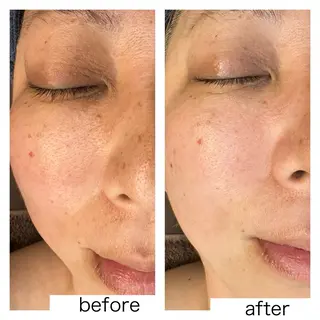 leolo武蔵浦和 肌質改善&脱毛のエステ・リラクイメージ