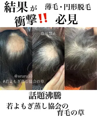 private salon Dea_maris シュガーリング&パーソナルボディケア所属・シミ改善・韓国肌管理 ボディメイク痩身のその他イメージ