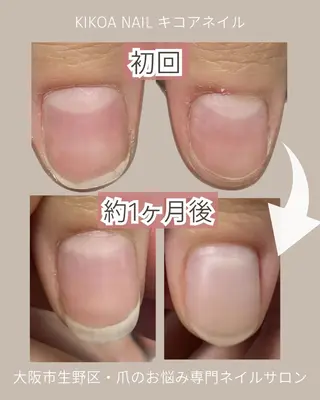 ネイル KIKOA NAIL キコアネイルのネイルデザイン