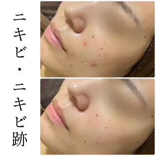 ハーブピーリング専門 BIOEL横浜のエステ・リラクイメージ