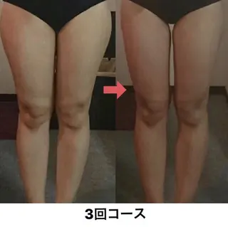 横浜エステサロン R-ing リングのエステ・リラクイメージ