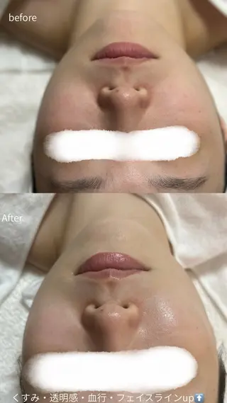 デ・アイム塚口所属・肌質/体質改善 久下玲菜のエステ・リラクイメージ