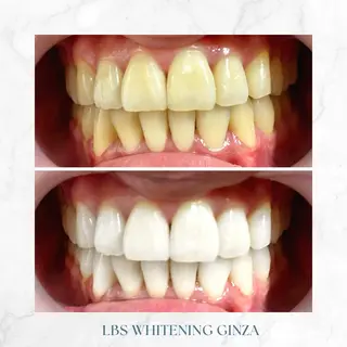 メンズ LBSホワイトニング 銀座店💎公式のその他イメージ