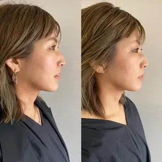 小顔SALON   MAREA所属・MAREA 小顔SALONのエステ・リラクイメージ