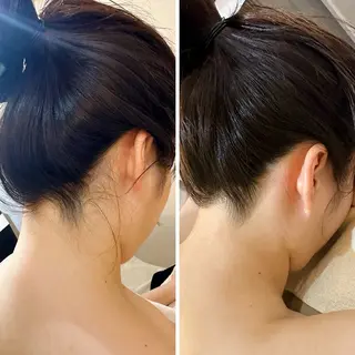 うなじ脱毛/美肌脱毛 LABELのエステ・リラクイメージ