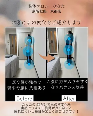 整体サロン　ひなた~HINATA~ 　京阪七条　京都店所属・肩こり反り腰改善専門 筋膜✨整体ひなたのエステ・リラクイメージ
