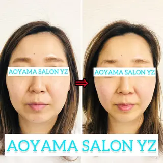 小顔美容鍼専門サロン 渋谷YZのエステ・リラクイメージ