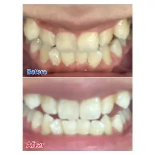 MBEAUTYSALON 千葉店・京成大久保所属・Melty 輝のその他イメージ