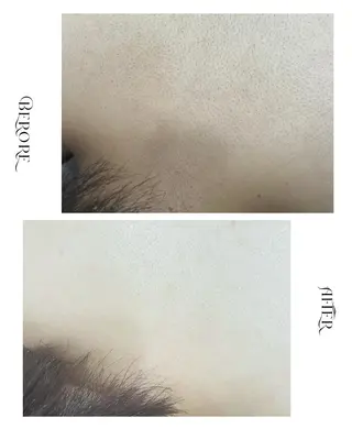 脱毛・肌質改善サロン Linoのエステ・リラクイメージ