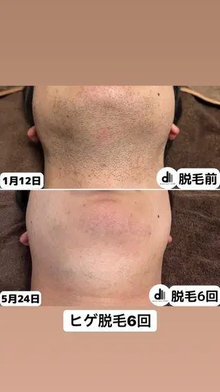 メンズ Beauty Salon MARU所属・新潟市メンズ【脱毛】 MARUのエステ・リラクイメージ