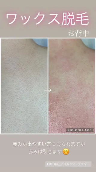 毛穴レス ハーブ& ワックス脱毛×光脱毛のエステ・リラクイメージ