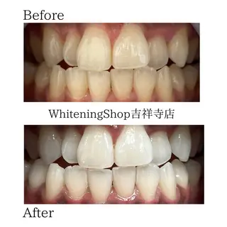 ホワイトニング ショップ吉祥寺店のエステ・リラクイメージ