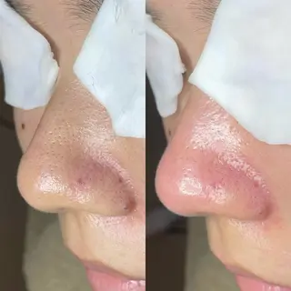 Re:Belle所属・Re:Belle 久留米 : 中島のエステ・リラクイメージ