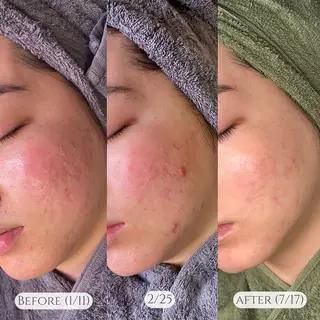 Mau beauty salon所属・Mau (マウ)のエステ・リラクイメージ