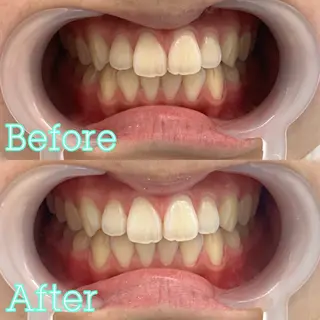 歯のホワイトニング専門店 MIGAQ 京都四条大宮店所属・佐藤 未来の眉毛・アイブロウイメージ