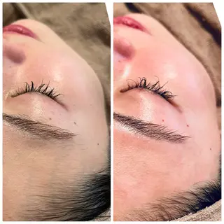 アイブロウ B&H所属・頭痛•肩こり専門/ 眉サロンB&H心斎橋のエステ・リラクイメージ