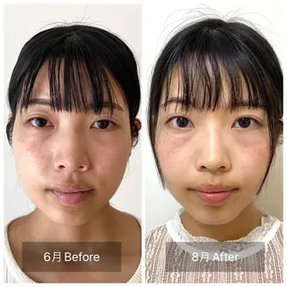 そとやまのはり おきゅう所属・外山 勝敏のエステ・リラクイメージ