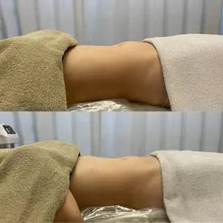 腸もみ・メンズ脱毛 毛穴洗浄カナロアのエステ・リラクイメージ
