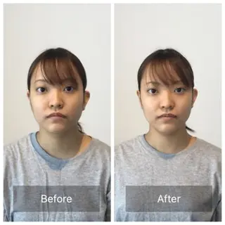 美容整体　小顔矯正 プラスフィール松村のエステ・リラクイメージ