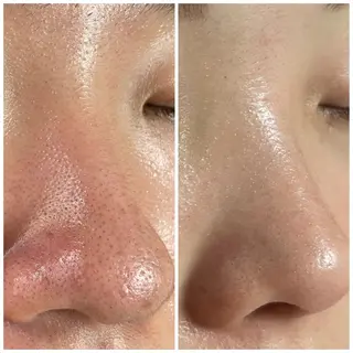 透明感の肌Lino malieのエステ・リラクイメージ