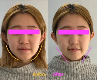 小顔美肌&痩身ｻﾛﾝ My Timeのエステ・リラクイメージ