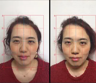 やはた鍼灸整骨院所属・やはた 鍼灸整骨院のエステ・リラクイメージ