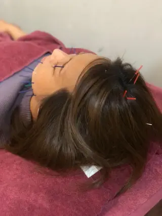 美容鍼灸女性専用 りんご鍼灸治療院のその他イメージ